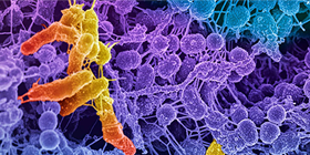 SIS Nyhetsbrev 2 2022 - Antimikrobiella ytor