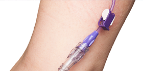 SIS Nyhetsbrev 2 2022 - Nya testmetoder för silikonkatetrar